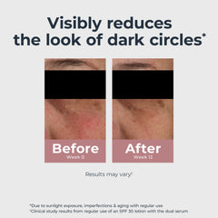 Eucerin Radiant Tone Eye Cream Thiamidol close-up highlights dark-circle correction.