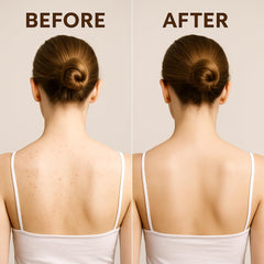 Euralissea Peel Shot Turmeric Mist body application promotes smooth comfortable skin