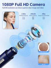EURART Visual Blackhead Remover live view shows real-time pore monitoring during care
