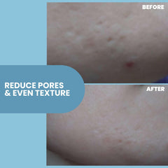 Eva Naturals niacinamide serum pore-refinement close-up showcases even tone.