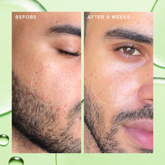 Farmacy toner with 2% BHA targets oil buildup for a calmer complexion
