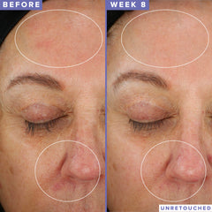 Face after applying Farmacy Niacinamide Overnight Mask shows morning glow and improved tone.