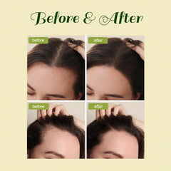 FEIBTH Natural Hair Growth Oil scalp-application scene shows quick massage for hydration.
