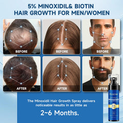 Felicemy 5% Minoxidil on beard area demonstrates targeted application.
