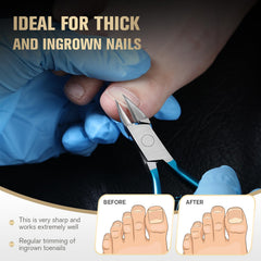 FERYES thick-nail clipper in action for durable, reliable performance.