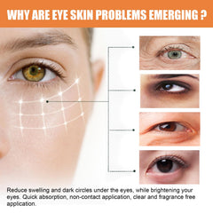 F FENG PEI hydrating eye cream application demonstrates under-eye moisture for refreshed look.
