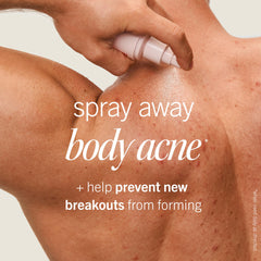 First Aid Beauty acne spray delivers a quick-dry mist for on-the-go use