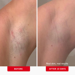 First Aid Beauty Ingrown Hair Pads texture close-up highlighting gentle exfoliating formula.
