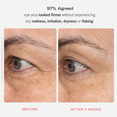First Aid Beauty encapsulated-retinol technology close-up for smoother eye area