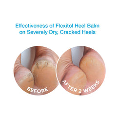 Flexitol Heel Balm pack of 2 display emphasizes value for consistent care.