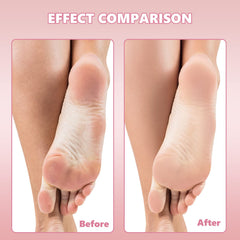Flutesan stainless steel pedicure refills pack ideal for salon or at-home spa routines.