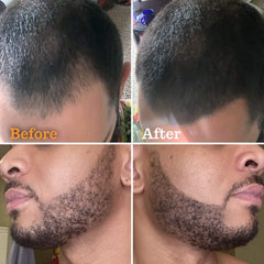 FOLLICLE BOOSTER beard pen filler applying streaks for seamless regrowth blend