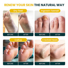 Foot Cure Citrus Detox epsom salts pour demonstrates relaxing soak and soothing foot muscles.