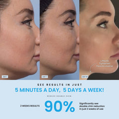 Forchics LiftLab jawline-tightening mode highlights contouring potential.