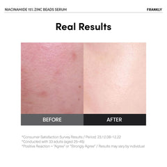 FRANKLY Niacinamide beads closeup showing bursting beads delivering fresh Niacinamide.