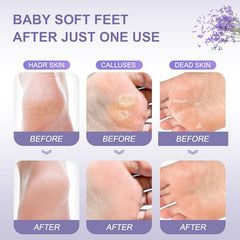 FUNNIR Foot Peeling Mask soft-feet result with refreshed heels.