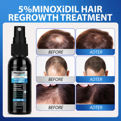 FUZYAT minoxidil spray ingredients Biotin Niacinamide for scalp nourishment