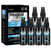 FUZYAT minoxidil spray bottle for scalp hair growth support.
