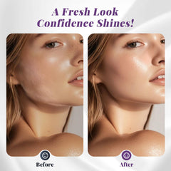 Galtxen dermaplaning tool LED light close-up, helps precise peach fuzz removal.