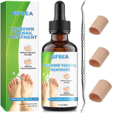 GIFBEA Ingrown Toenail Drops bottle in-hand for gentle relief before trimming.