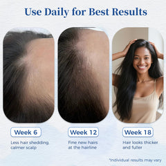 User applying Gluvelessia Hair Growth Serum Roll-On to thinning hair areas for better coverage.