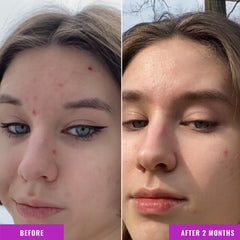 Good Molecules Niacinamide Serum texture close-up highlighting lightweight hydration.