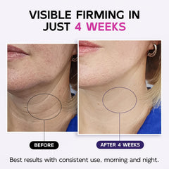 GOOSURE neck cream with retinol and hyaluronic acid close-up highlights hydrating, plumping formula.