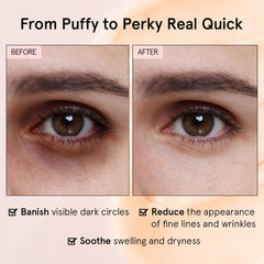 Grace & Stella caffeine-niacinamide formula helps reduce dark circles and puffiness.
