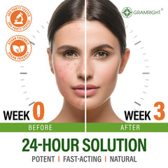 GRAMRIGHT salicylic-acid formula offers gentle exfoliation for smooth texture.