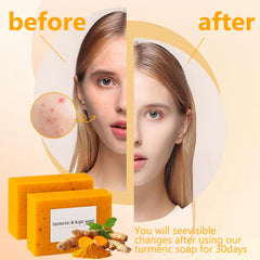 Guluxly Lemon Turmeric Kojic Soap lather demonstrates moisturizing action for everyday hydration.