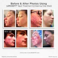 Gunilla Of Sweden LEROSETT cream-texture mask being applied for gentle cleansing
