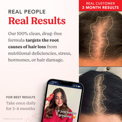 HAIRtamin Advanced Formula daily-dose imagery showing one capsule a day.