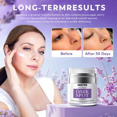 HANYWIL Dark Spot Remover serum dropper brightening facial discoloration.