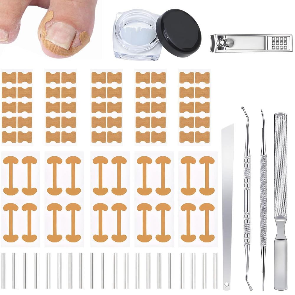 HDFDREO ingrown toenail corrector set packaging highlights a comprehensive home-care kit.