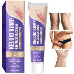 Hemir Keloid Bump Removal Cream packaging for daily at-home scar care.