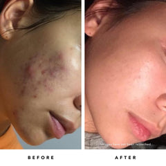 HERBIVORE Blue Tansy mask pore refinement highlights smoother-looking pores.