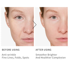 HKH Niacinamide Serum Capsules help even skin tone for a smoother look.