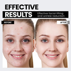 Hunvva EP-300 neck contouring for a firmer profile