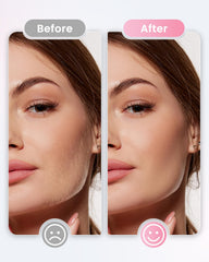 Hyhail Dermaplane Razor three speeds enable personalized gentle sessions.