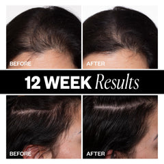 IGK Pumpkin seed oil image emphasizing anti-inflammatory feel and scalp comfort.