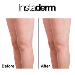 Instaderm Vitamin K Cream under-eye jar reducing dark circles and puffiness.