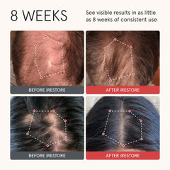 irestore biotin formula ingredients closeup nourish scalp for fuller hair