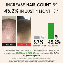 iRestore Essential Laser Hair Growth System lightweight design for comfortable wear.