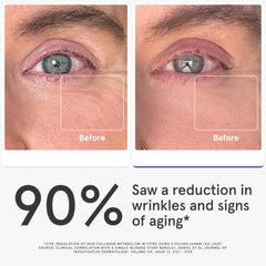 iRestore eye mask targets the under-eye area with red and infrared light therapy.