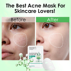 Close-up of IREV sheet mask ready to address pores and impurities.
