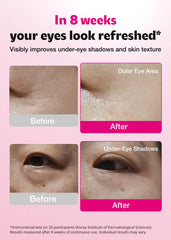 ISOI Blemish Care Under Eye Patch application shows cooling relief for puffiness and dark circles.