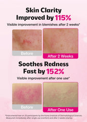Close-up of ISOI Blemish Care Up Serum texture on skin showing smooth finish