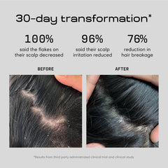 Jupiter Anti Dandruff Shampoo label closeup highlights color-safe, sulfate-free formula.