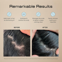 Jupiter scalp exfoliator bristle close-up with flexible tips that gently lift flakes and residue