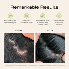 Jupiter Scalp Exfoliator bristles closeup highlights multi-height bristles for gentle exfoliation.